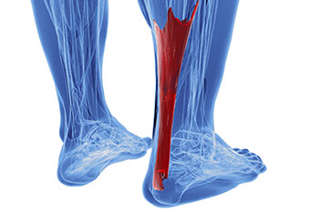 Achilles tendon treatment in the Hanover, PA area